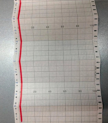 Papel de gráfico EL05081 para CHINO AL,EL,EM Série Z-FOLD CHART 100 mm (114 mm) Papel de registo EL05081 fornecedor